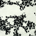Cancer Cells Part 2 thumb